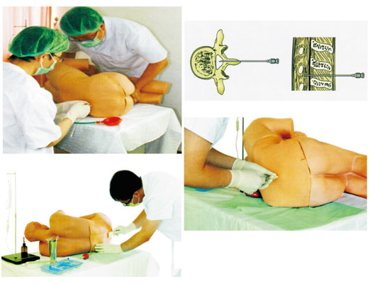 知能醫(yī)學腰椎穿刺仿真模擬人怎么用？