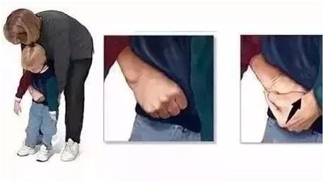 寶寶誤吞異物，怎么緊急處理！