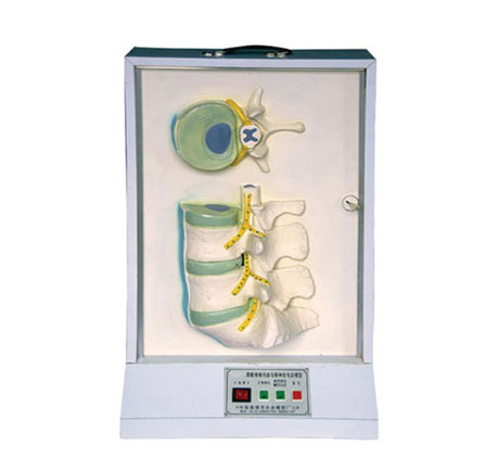 腰骶椎、椎間盤和脊神經(jīng)電動模型