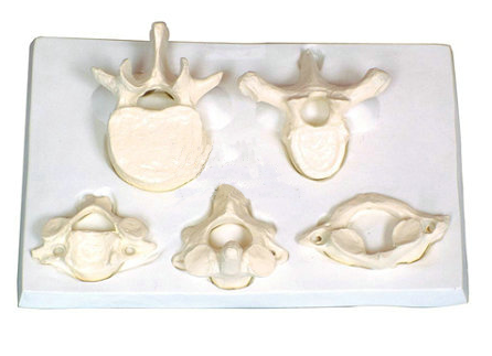 寰、樞、頸、胸、腰椎放大模型